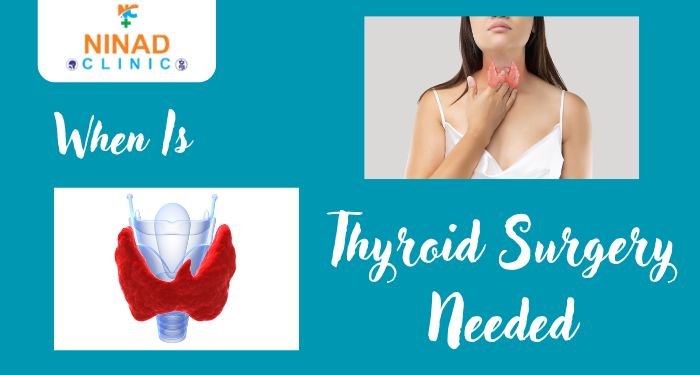 Learn when thyroid gland surgery is necessary, symptoms to watch , recovery tips. Consult an experienced ENT specialist in Pimpri Chinchwad