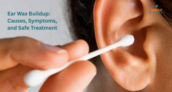 Learn about ear wax buildup, symptoms, safe removal, and prevention. Consult an experienced Ear Specialist in PCMC and ENT Specialist in Pimple Nilakh for expert care.