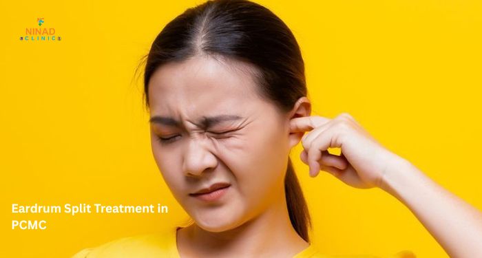 ENT doctor examining ruptured eardrum